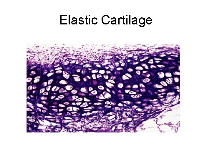 Elastic Cartilage Elastic Cartilage