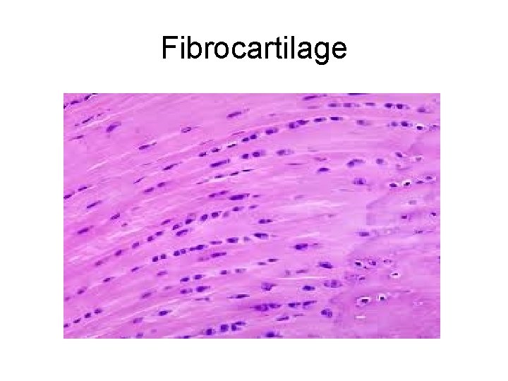 Fibrocartilage Fibrocartilage