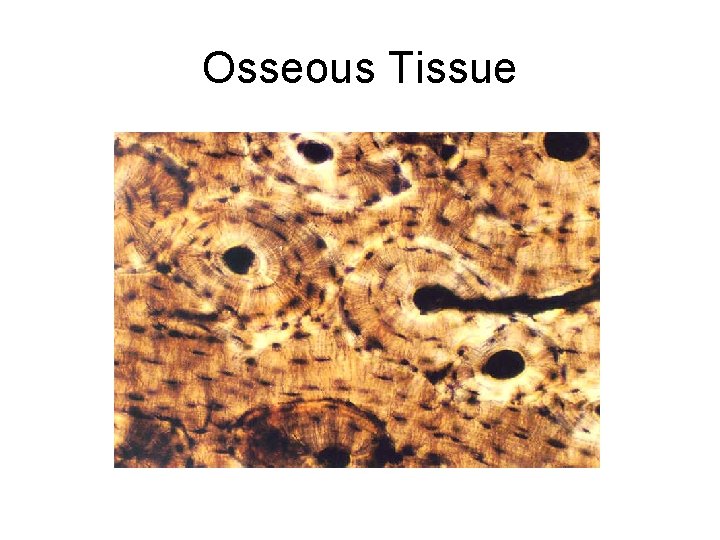 Osseous Tissue Osseous Tissue
