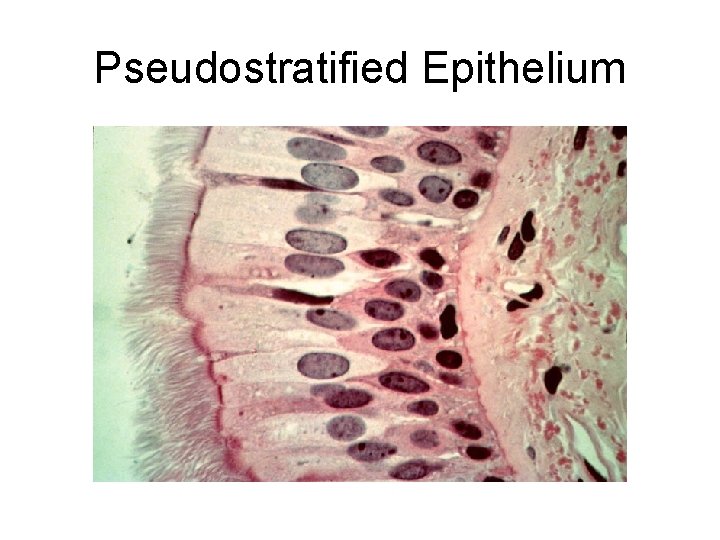 Pseudostratified Epithelium Pseudostratified Epithelium