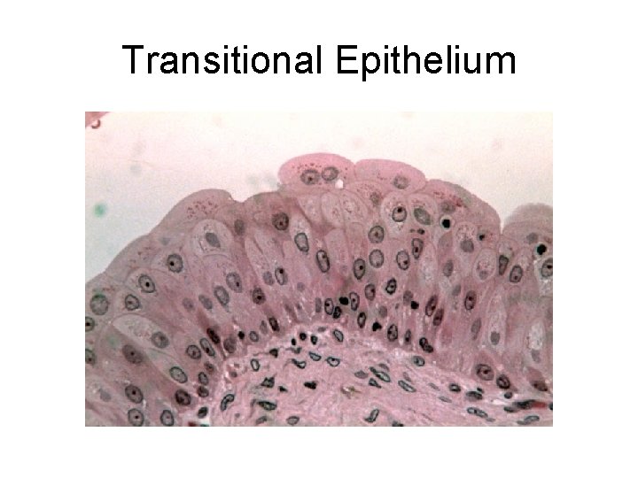 Transitional Epithelium Transitional Epithelium