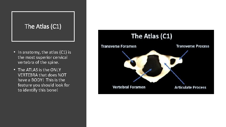The Atlas (C 1) • In anatomy, the atlas (C 1) is the most