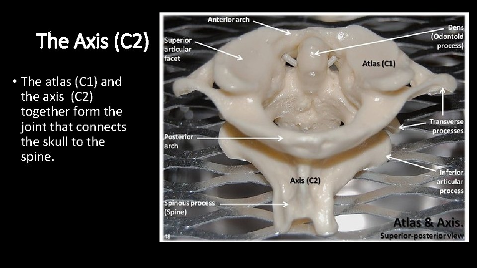 The Axis (C 2) • The atlas (C 1) and the axis (C 2)