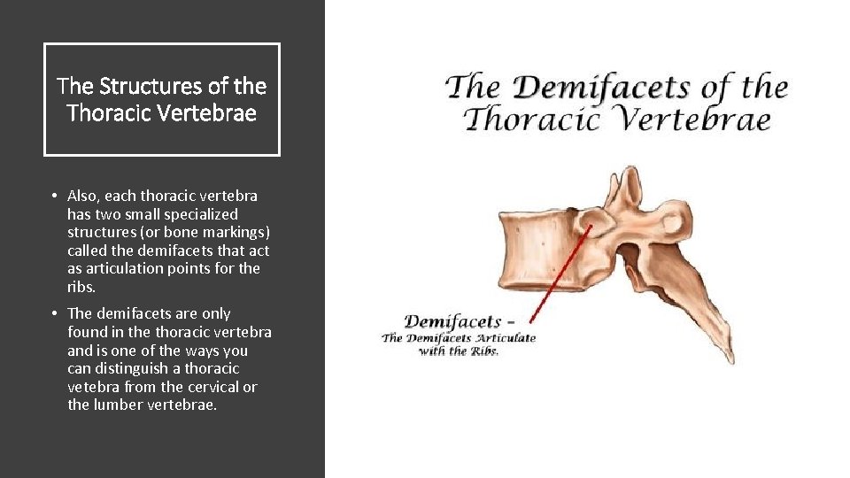 The Structures of the Thoracic Vertebrae • Also, each thoracic vertebra has two small