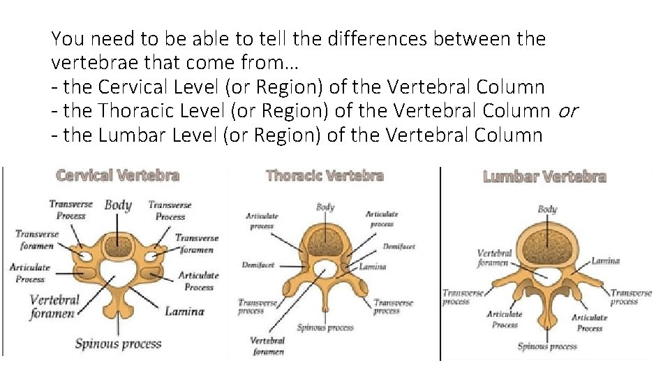 You need to be able to tell the differences between the vertebrae that come