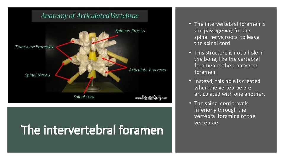  • The intervertebral foramen is the passageway for the spinal nerve roots to