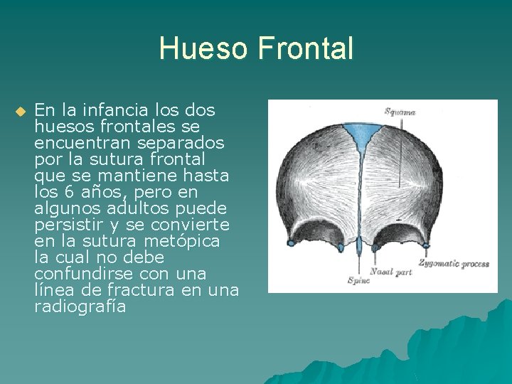 Hueso Frontal u En la infancia los dos huesos frontales se encuentran separados por