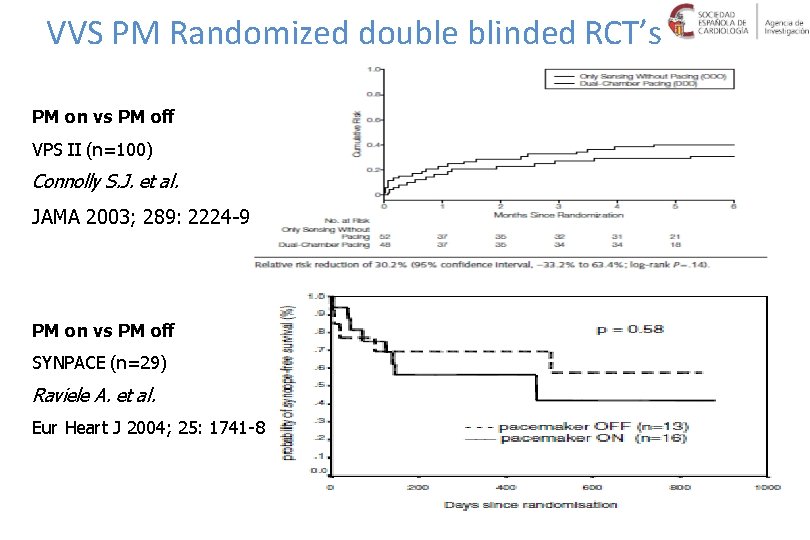 VVS PM Randomized double blinded RCT’s PM on vs PM off VPS II (n=100)