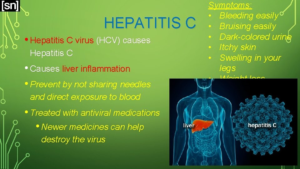 HEPATITIS C • Hepatitis C virus (HCV) causes Hepatitis C • Causes liver inflammation