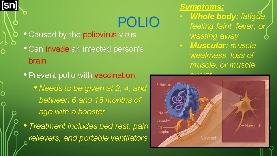POLIO • Caused by the poliovirus • Can invade an infected person's brain •