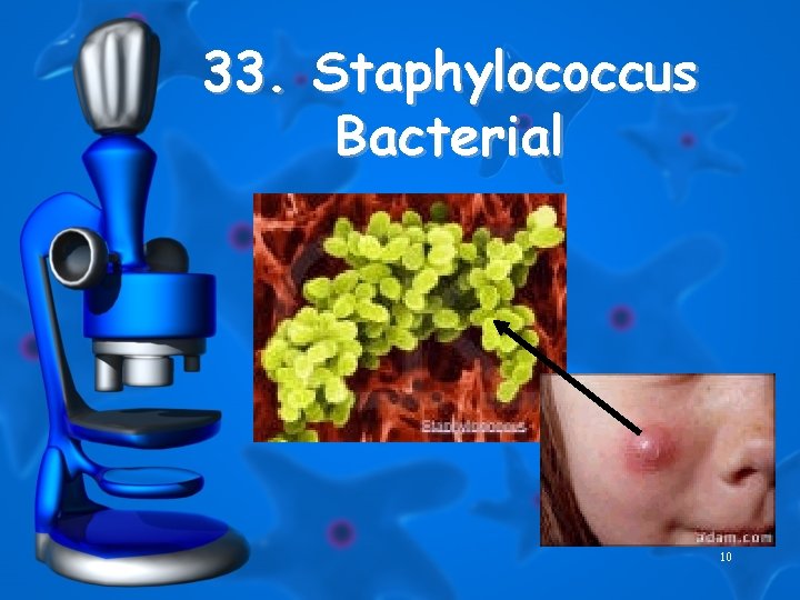 33. Staphylococcus Bacterial 10 