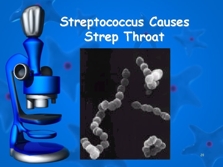 Streptococcus Causes Strep Throat 20 