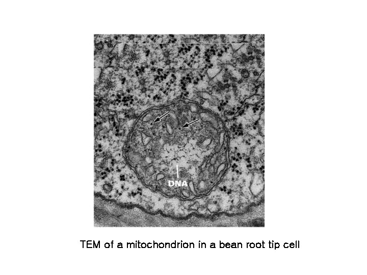TEM of a mitochondrion in a bean root tip cell 