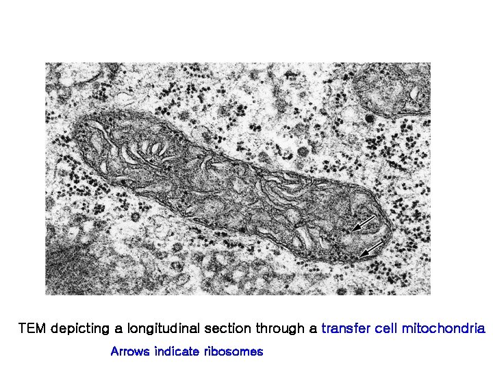 TEM depicting a longitudinal section through a transfer cell mitochondria Arrows indicate ribosomes 
