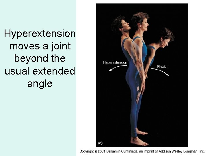 Hyperextension moves a joint beyond the usual extended angle 