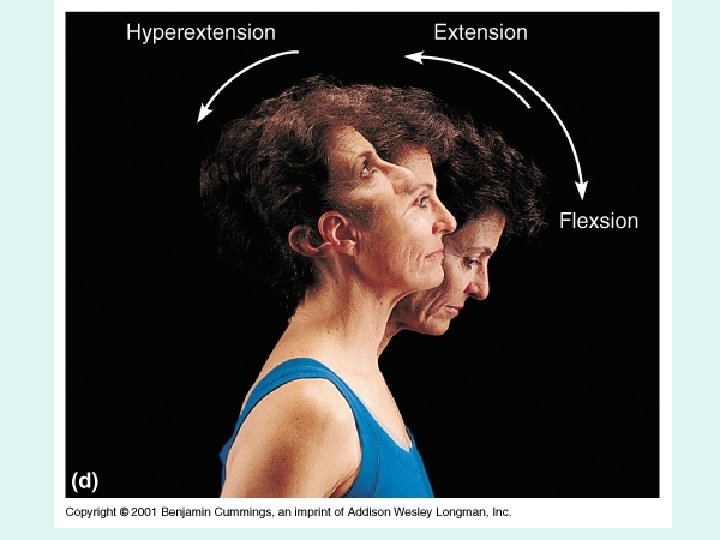 Movements of the neck Movements of the neck