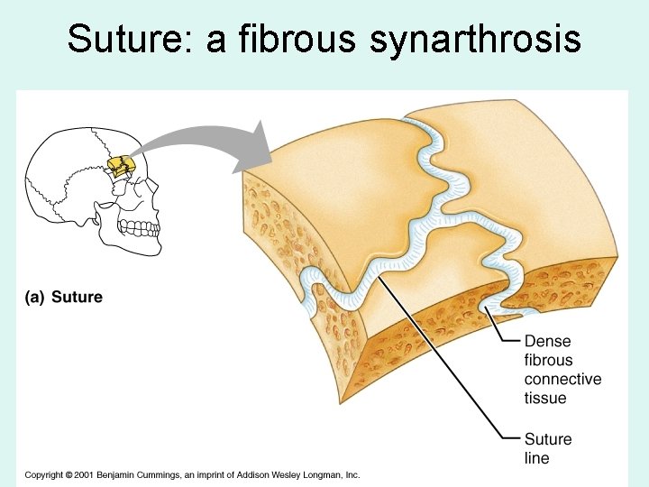 Suture: a fibrous synarthrosis 