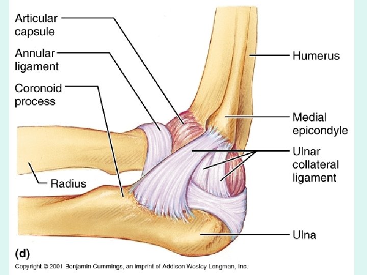 The Elbow reverse view 