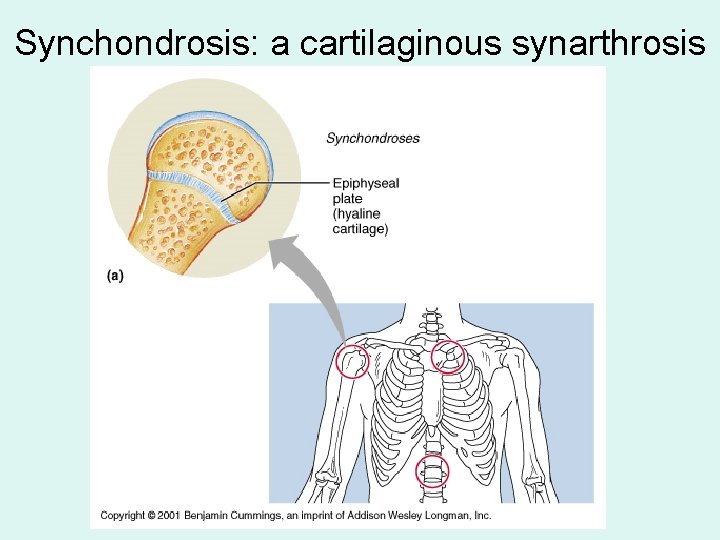Synchondrosis: a cartilaginous synarthrosis Synchondrosis: a cartilaginous synarthrosis