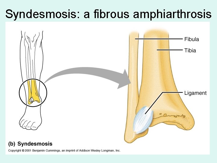 Syndesmosis: a fibrous amphiarthrosis 