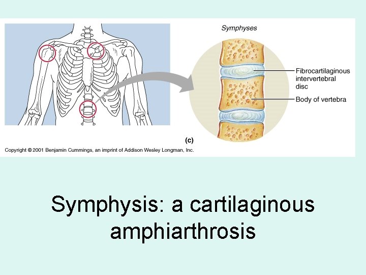 Symphysis: a cartilaginous amphiarthrosis 