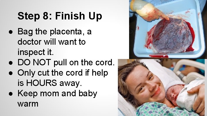 Step 8: Finish Up ● Bag the placenta, a doctor will want to inspect