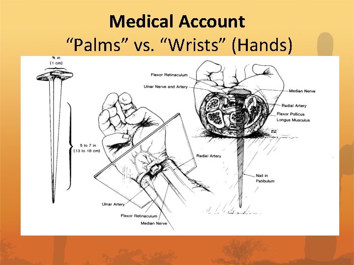 Medical Account “Palms” vs. “Wrists” (Hands) 