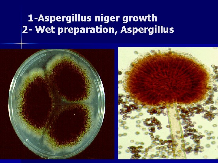 1 -Aspergillus niger growth 2 - Wet preparation, Aspergillus 