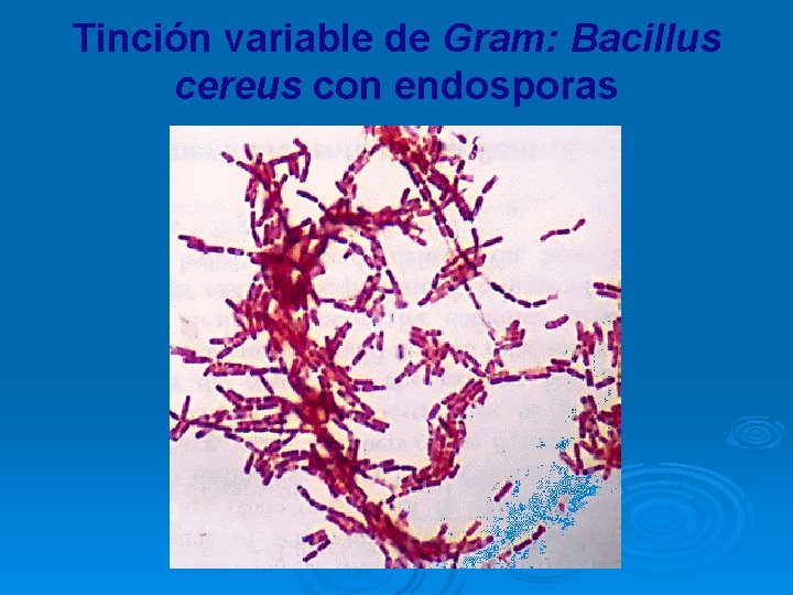 Tinción variable de Gram: Bacillus cereus con endosporas 