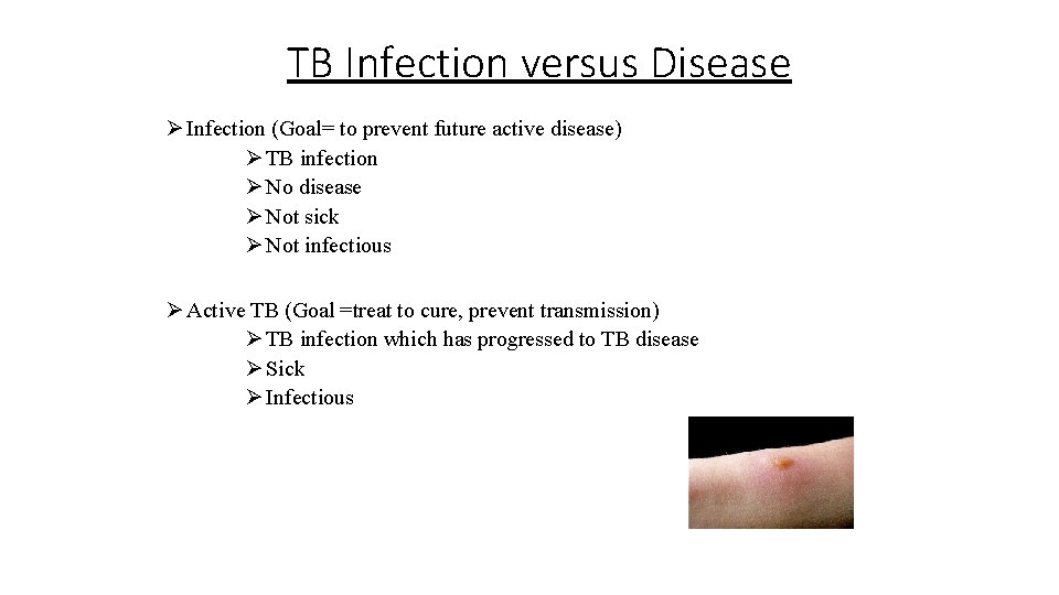 TB Infection versus Disease Ø Infection (Goal= to prevent future active disease) Ø TB