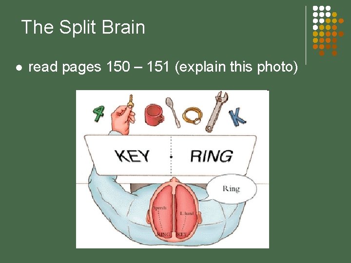 The Split Brain l read pages 150 – 151 (explain this photo) 
