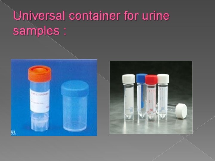 Universal container for urine samples : 