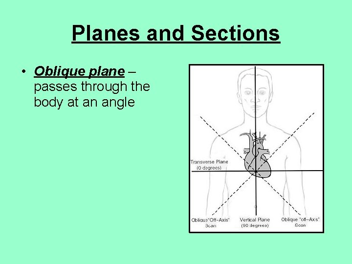 Planes and Sections • Oblique plane – passes through the body at an angle