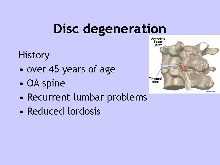 Disc degeneration History • over 45 years of age • OA spine • Recurrent