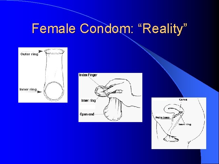 Female Condom: “Reality” 