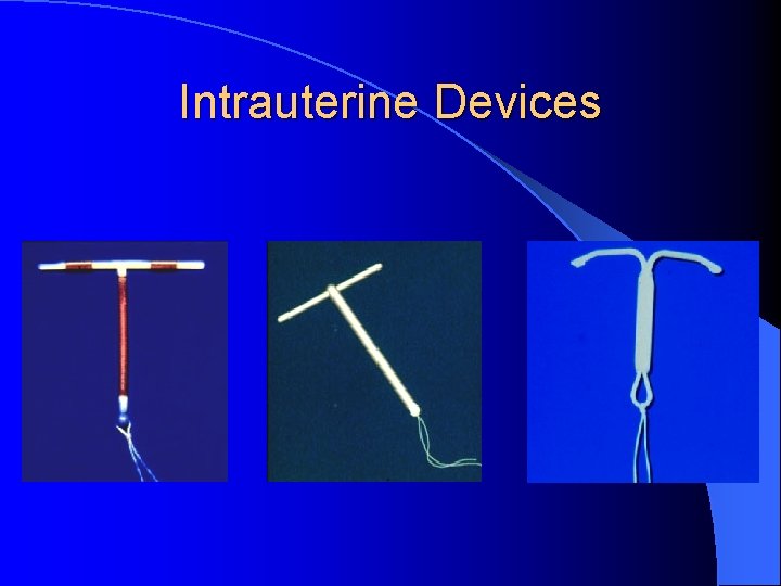 Intrauterine Devices 