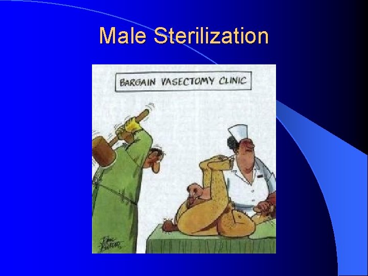 Male Sterilization 