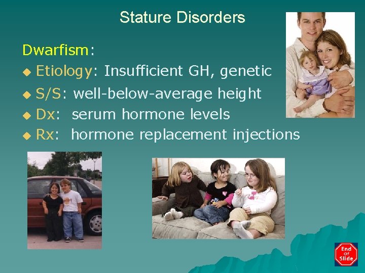 Stature Disorders Dwarfism: u Etiology: Insufficient GH, genetic S/S: well-below-average height u Dx: serum
