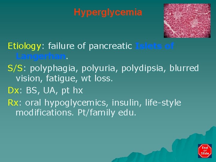 Hyperglycemia Etiology: failure of pancreatic Islets of Langerhan. S/S: polyphagia, polyuria, polydipsia, blurred vision,