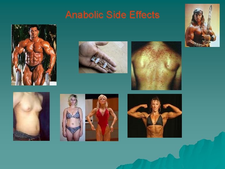 Anabolic Side Effects 
