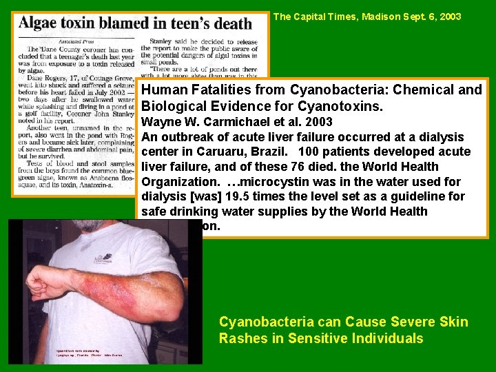 The Capital Times, Madison Sept. 6, 2003 Human Fatalities from Cyanobacteria: Chemical and Biological