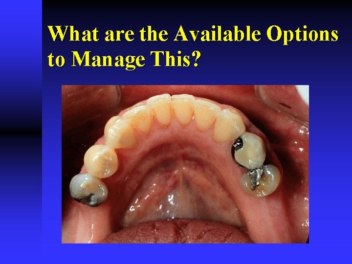 What are the Available Options to Manage This? 