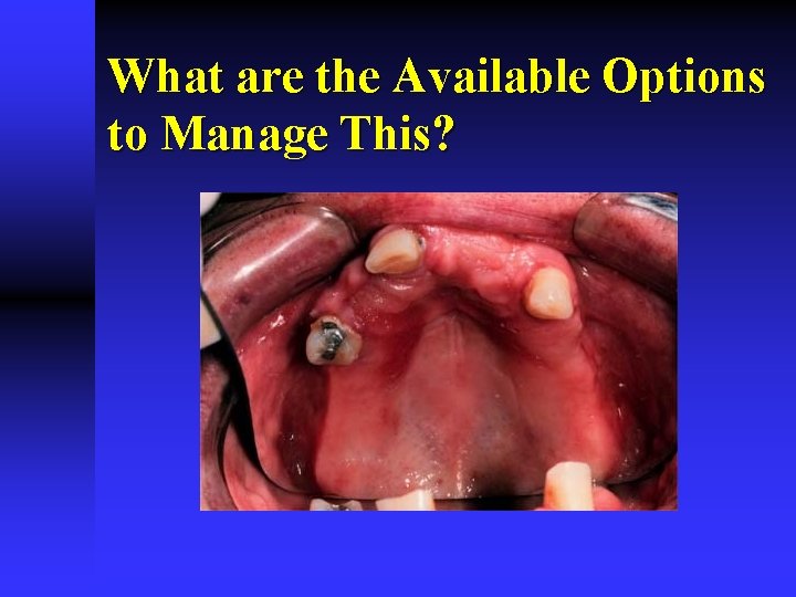 What are the Available Options to Manage This? 