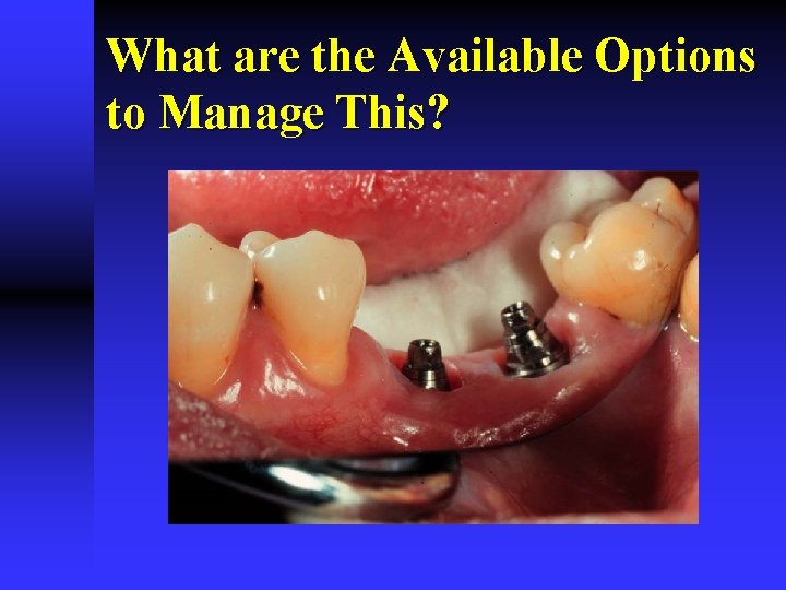 What are the Available Options to Manage This? 