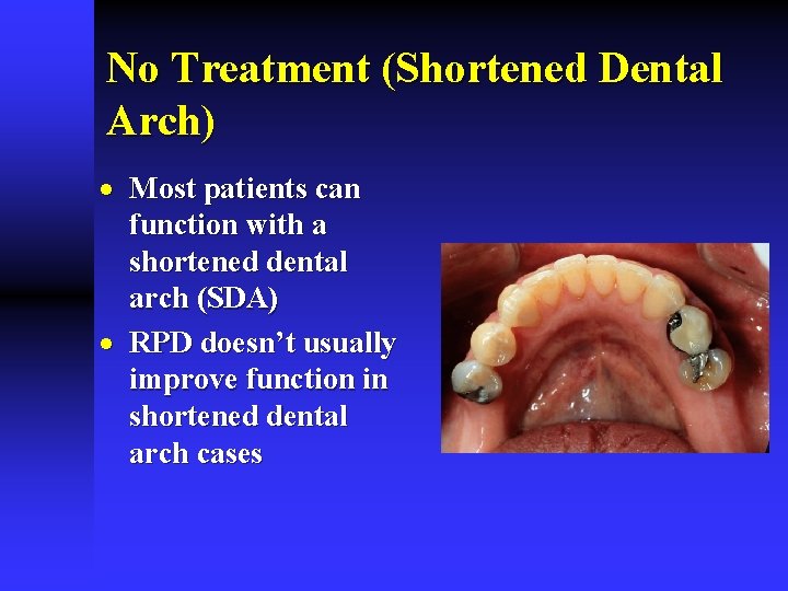 No Treatment (Shortened Dental Arch) · Most patients can function with a shortened dental