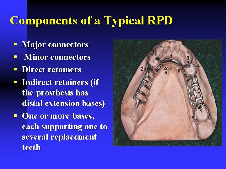 Components of a Typical RPD § § Major connectors Minor connectors Direct retainers Indirect
