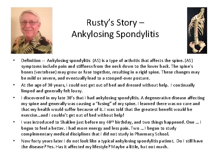 Rusty’s Story – Ankylosing Spondylitis • • • Definition -- Ankylosing spondylitis (AS) is