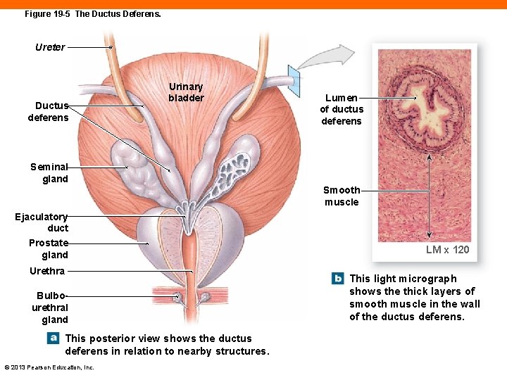 Figure 19 -5 The Ductus Deferens. Ureter Ductus deferens Urinary bladder Lumen of ductus