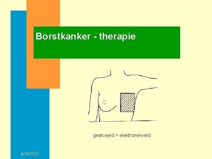 Borstkanker - therapie gearceerd = elektronenveld 6/16/2021 