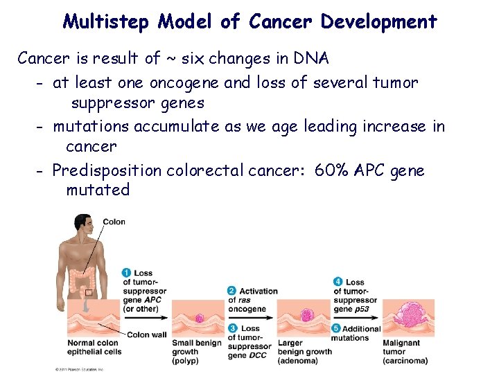 Multistep Model of Cancer Development Cancer is result of ~ six changes in DNA
